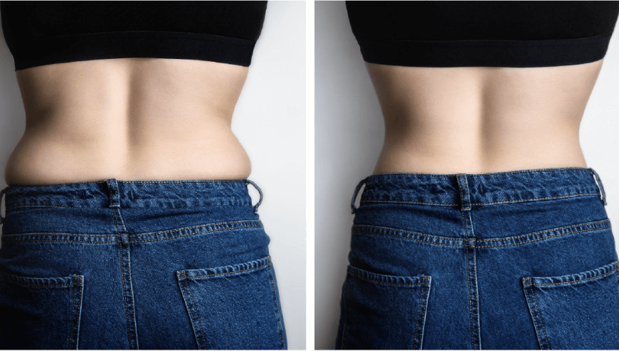 Dr Chong Slimming | Before After